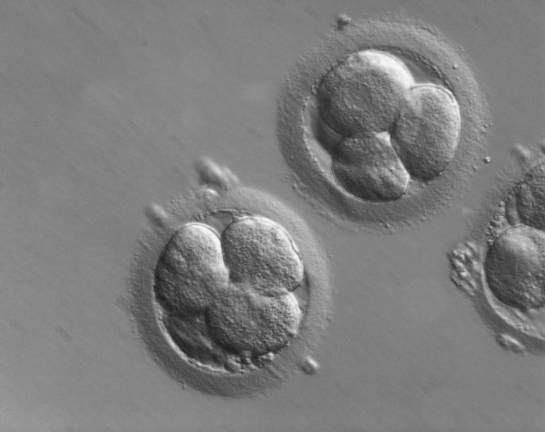 Early human embryos, in vitro fertilization (IVF)