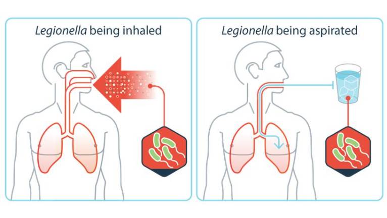 A Legionnaires’ outbreak in Harlem has now sickened 67 people, killing three.